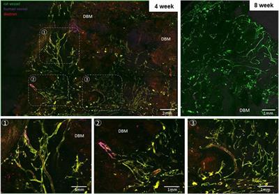 A Biofabrication Strategy for a Custom-Shaped, Non-Synthetic Bone Graft Precursor with a Prevascularized Tissue Shell